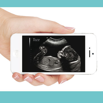 Ultrasounds delivered by text or email.